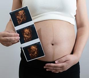 Mulher grávida segura imagens de ultrassom morfológico em frente à barriga, representando a importância do exame para o acompanhamento da gestação.