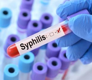 Tubo de ensaio com o rótulo 'Syphilis', representando um exame de diagnóstico para sífilis.